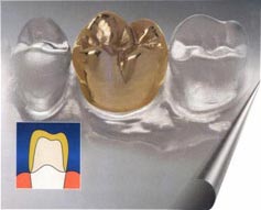 лечение или удаление зубов