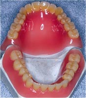 Полные съемные протезы для зубов